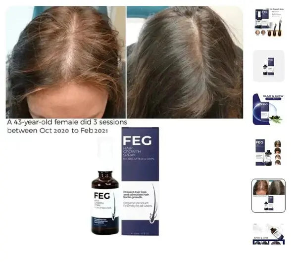 FEG™ Hair Spary - Hair Growth Solution 50ml Emira Mart